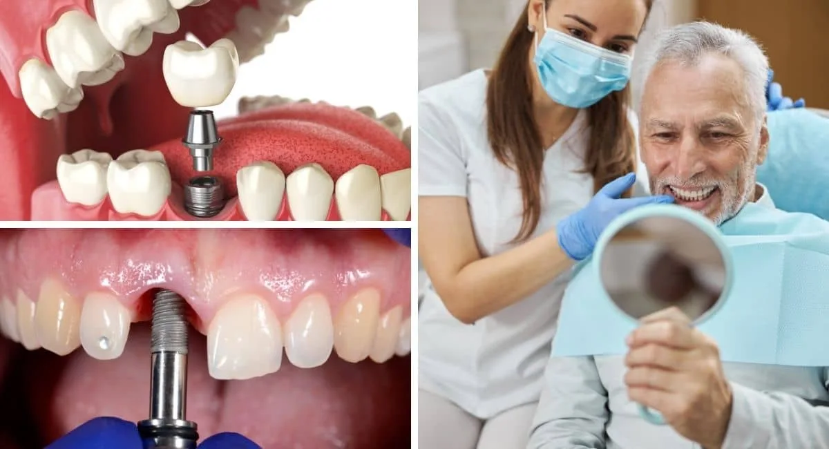 Top Istanbul Dental Clinics