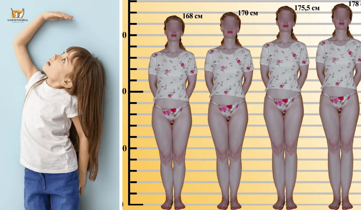 Limb Lengthening Surgery Istanbul