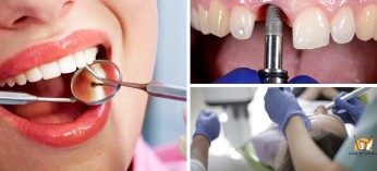 الدليل الشامل لأفضل مراكز طب الأسنان في إسطنبول