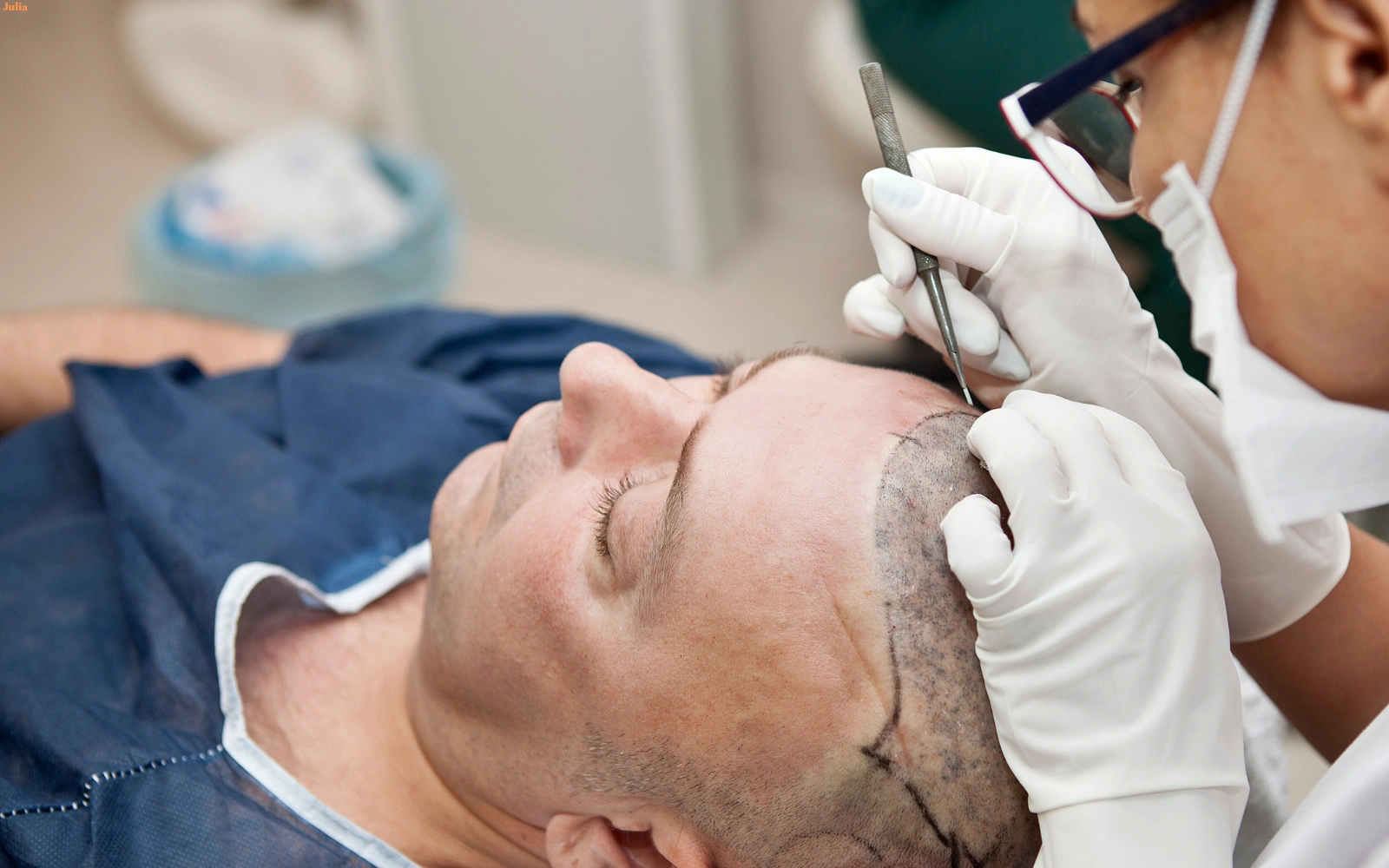 Private airport transfer for hair transplant visitors to Istanbul — Mercedes at hotel drop-off