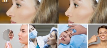 Guide of Rhinoplasty in Istanbul: Navigating Aesthetic Choices