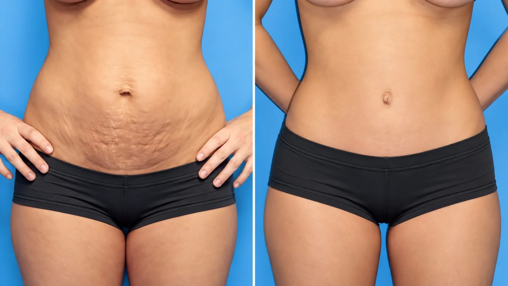 Istanbul Plastic Surgery Guide 2026: Surgeons, Clinics, Procedures & Patient Planning